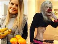 मोटापे के डर से हुआ ऐसा हाल