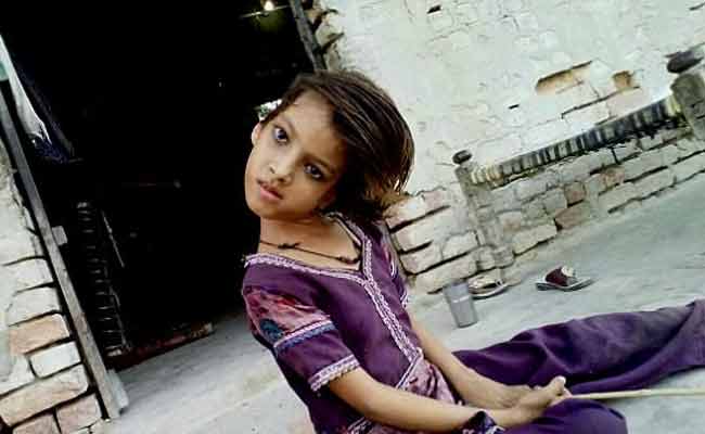 Image result for बच्ची का सिर है टेढ़ा