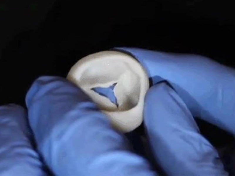 3D à¤ªà¥à¤°à¤¿à¤à¤à¥à¤¡ à¤¹à¤¾à¤°à¥à¤ à¤¬à¤¨à¤¾à¤¨à¥ à¤à¥ à¤à¤°à¥à¤¬ à¤ªà¤¹à¥à¤à¤à¥ à¤µà¥à¤à¥à¤à¤¾à¤¨à¤¿à¤, à¤¹à¥à¤à¤¾ à¤¯à¤¹ à¤«à¤¾à¤¯à¤¦à¤¾