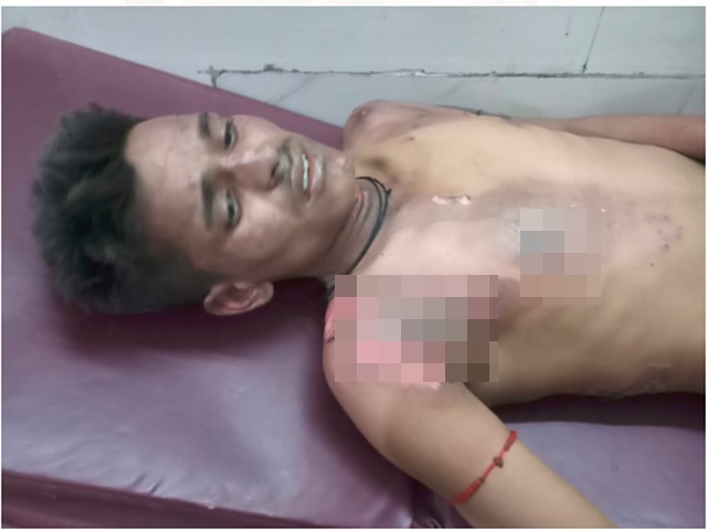 Damoh Bus Accident : हाई टेंशन लाइन की चपेट में आई बारातियों से भरी बस, आधा दर्जन झुलसे