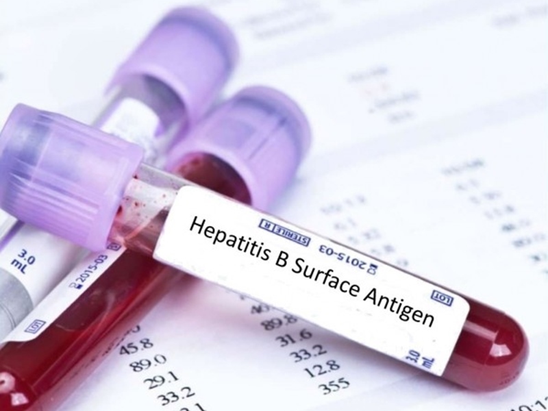 NAT Test : दो महीने की जगह 15 दिन में ही पकड़ में आ जाएगा Hepatitis-B का संक्रमण